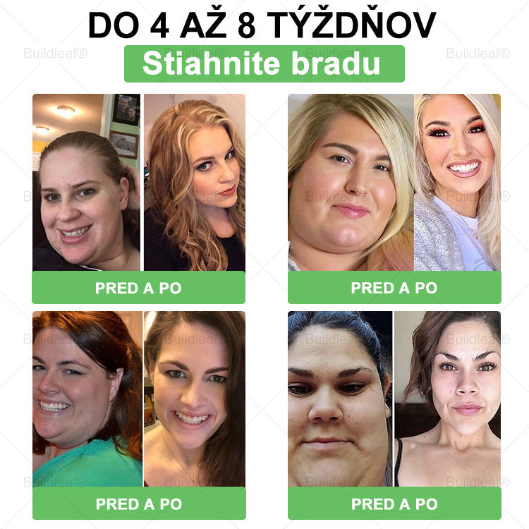 🧑‍⚕️🧑‍⚕️BuildLeaf® GLP-1 8-v-1 Fit & Vital Perorálny Roztok (Len raz denne, viditeľné zmeny už za 7 dní) Pre obezitu, kardiovaskulárne ochorenia, cukrovku, spánkové apnoe, zdravie čriev, problémy s kĺbmi a ďalšie