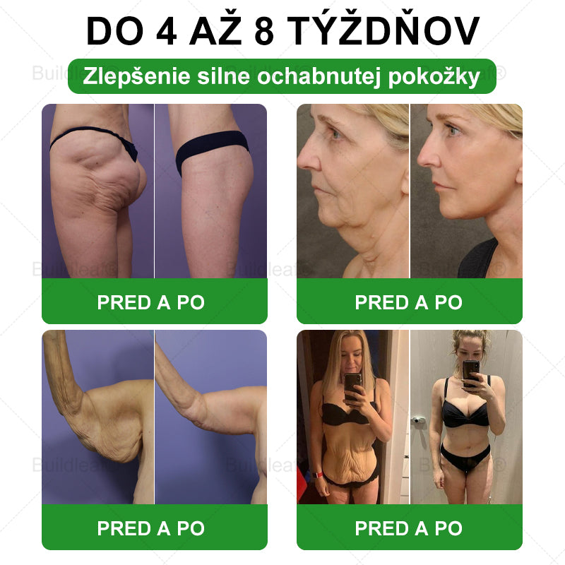 🍏🍏🍏BuildLeaf® GLP-1 6-v-1 Fit & Vital Perorálny Roztok ✅ (Len raz denne, viditeľné zmeny už za 7 dní) Pre obezitu, kardiovaskulárne ochorenia, cukrovku, spánkové apnoe, zdravie čriev, problémy s kĺbmi a ďalšie