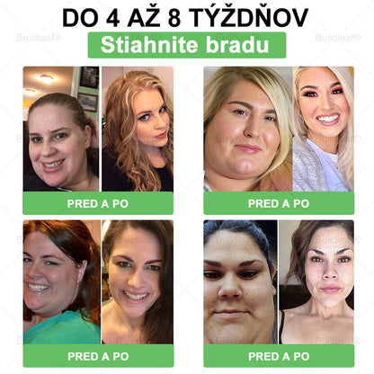 🍏🍏🍏BuildLeaf® GLP-1 6-v-1 Fit & Vital Perorálny Roztok ✅ (Len raz denne, viditeľné zmeny už za 7 dní) Pre obezitu, kardiovaskulárne ochorenia, cukrovku, spánkové apnoe, zdravie čriev, problémy s kĺbmi a ďalšie